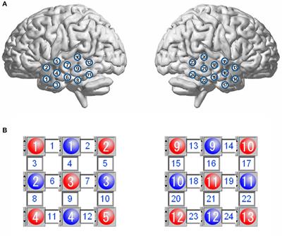 Narrowband Resting-State fNIRS Functional Connectivity in Autism Spectrum Disorder